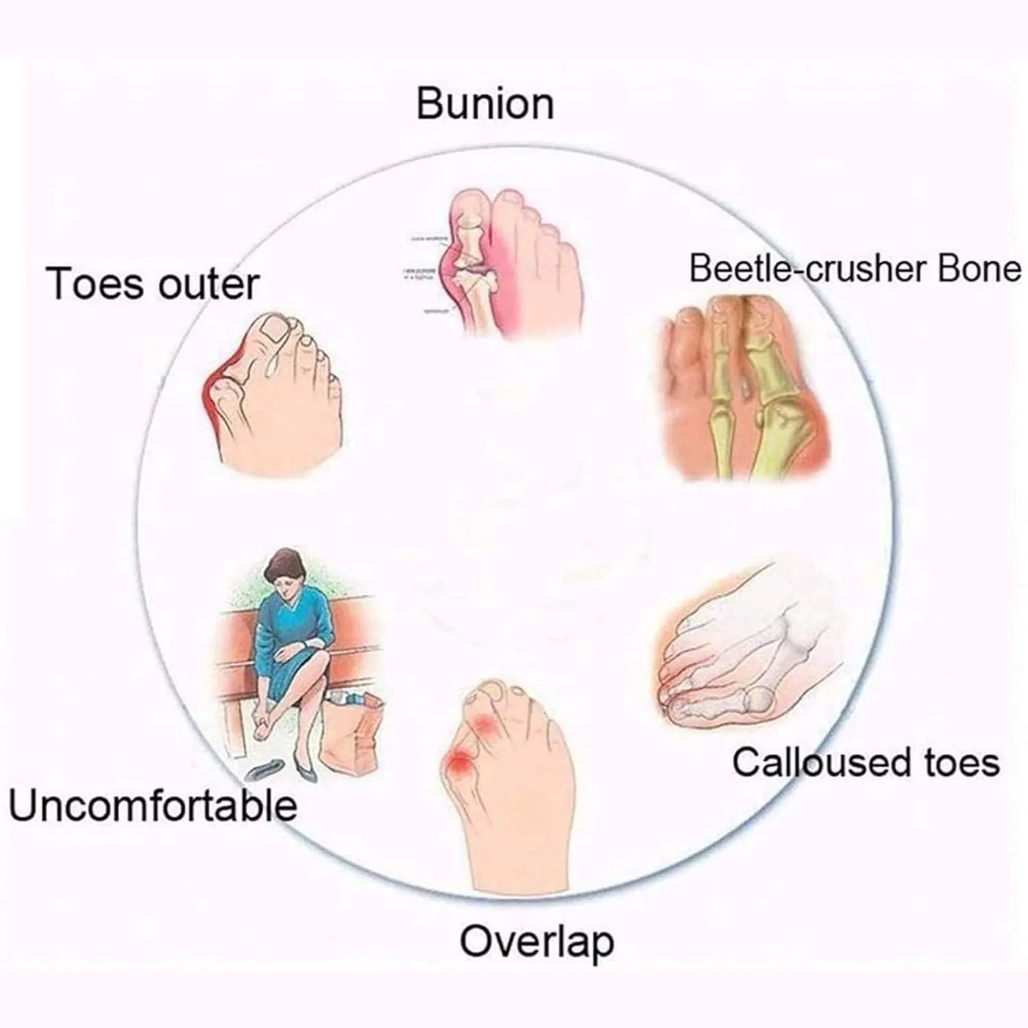 Women Flat Pu Leather Shoes, Summer Outdoor Beach Women's Orthopedic Correction Leather Ring Toe Casual, for Plantar Fasciitis Correction Slippers